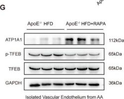 Fig.7.G showing Western Blotting in a Mus musculus (House mouse) sample from the publication: Low Shear Stress Promotes Atherosclerosis by Mediating Pathological Accumulation of Endothelial Lipid Droplets via the KLF4/TFEB/ATP1A1 Axis.