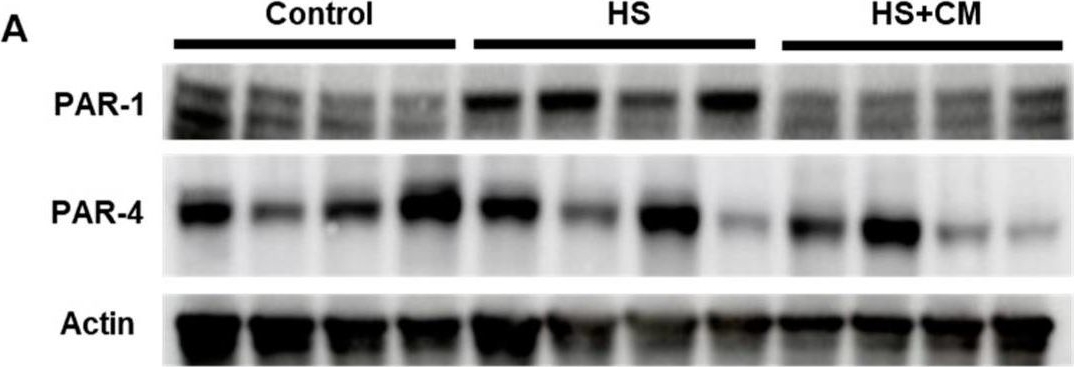 Fig.5.A showing Western Blotting in a Rattus norvegicus (Rat) sample from the publication: A Serine Protease Inhibitor, Camostat Mesilate, Suppresses Urinary Plasmin Activity and Alleviates Hypertension and Podocyte Injury in Dahl Salt-Sensitive Rats.