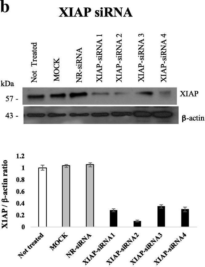 Fig.6.B showing Western Blotting from the publication: Glucocorticoid-dependent expression of IAP participates in the protection against TNF-mediated cytotoxicity in MCF7 cells.