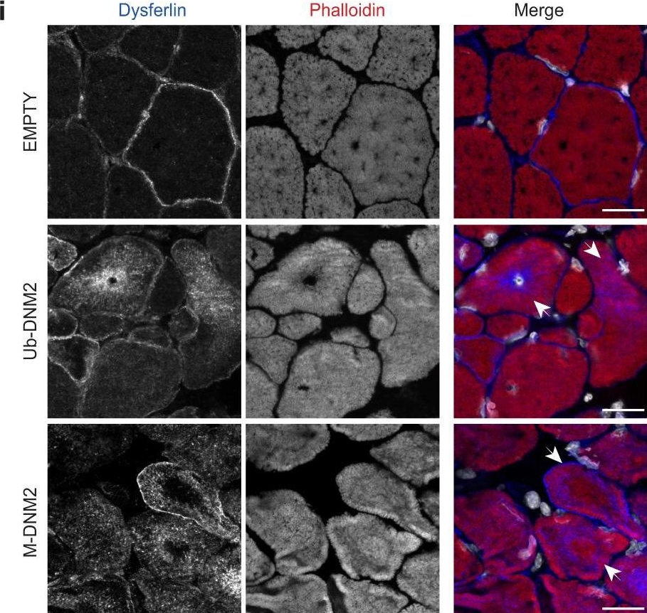 Fig.5.I showing Immunohistochemistry-immunofluorescence from the publication: Differential impact of ubiquitous and muscle dynamin 2 isoforms in muscle physiology and centronuclear myopathy.