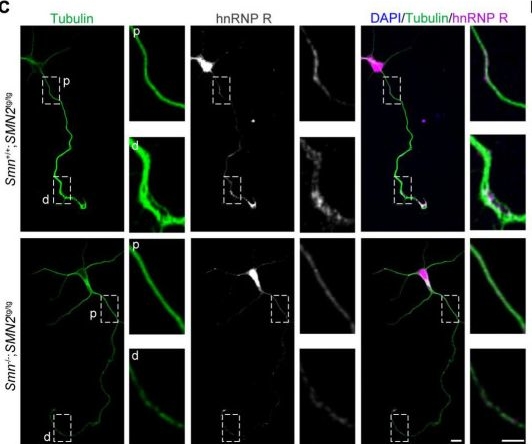 Fig.3.C showing Immunocytochemistry-immunofluorescence from the publication: Ptbp2 re-expression rescues axon growth defects in Smn-deficient motoneurons.