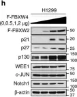 Fig.3.H showing Western Blotting from the publication: The β-TrCP-FBXW2-SKP2 axis regulates lung cancer cell growth with FBXW2 acting as a tumour suppressor.