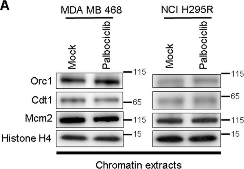 Fig.5.A showing Western Blotting in a Homo sapiens (Human) sample from the publication: Firing of Replication Origins Is Disturbed by a CDK4/6 Inhibitor in a pRb-Independent Manner.