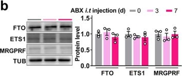 Fig.8.B showing Western Blotting from the publication: Gut microbes-spinal connection is required for itch sensation.