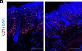 Fig.5.D showing Immunohistochemistry-immunofluorescence in a Mus musculus (House mouse) sample from the publication: Dermal fibroblasts respond to IL-4 and IL-13 and promote T cell recruitment in atopic dermatitis.