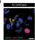 Fig.7.I showing Immunohistochemistry-frozen immunofluorescence in a Mus musculus (House mouse) sample from the publication: Cathelicidins prime platelets to mediate arterial thrombosis and tissue inflammation.