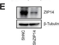 Fig.4.E showing Western Blotting in a Homo sapiens (Human) sample from the publication: Dihydroartemisinin Sensitizes Lung Cancer Cells to Cisplatin Treatment by Upregulating ZIP14 Expression and Inducing Ferroptosis.