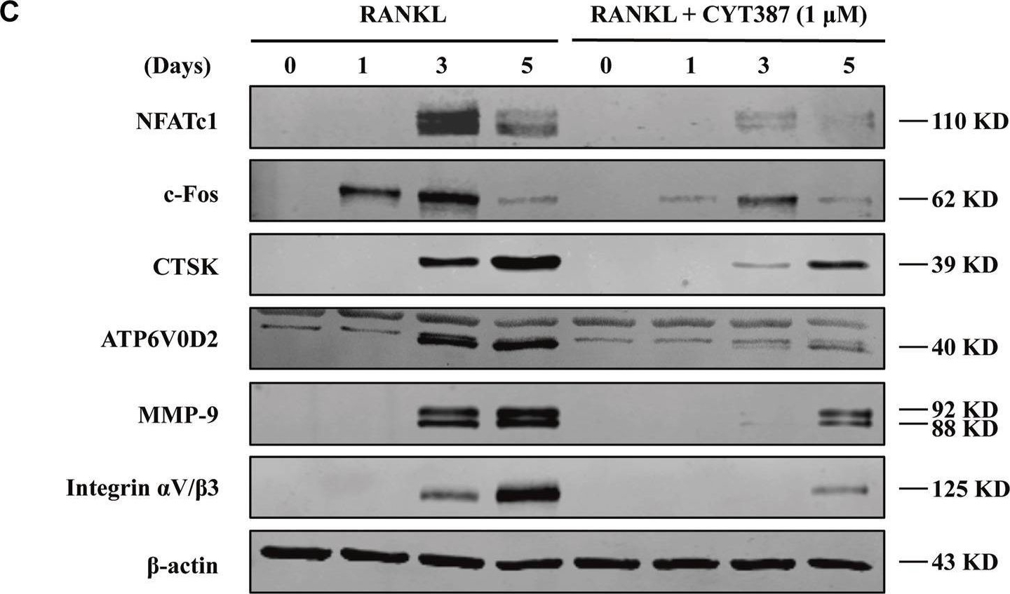 Fig.3.C showing Western Blotting in a Mus musculus (House mouse) sample from the publication: CYT387, a JAK-Specific Inhibitor Impedes Osteoclast Activity and Oophorectomy-Induced Osteoporosis via Modulating RANKL and ROS Signaling Pathways.