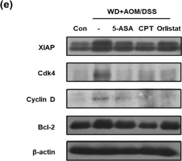 Fig.6.E showing Western Blotting in a Mus musculus (House mouse) sample from the publication: Anti-Obesity Drug Orlistat Alleviates Western-Diet-Driven Colitis-Associated Colon Cancer via Inhibition of STAT3 and NF-κB-Mediated Signaling.
