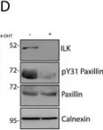 Fig.5.D showing Western Blotting from the publication: The Integrin-Mediated ILK-Parvin-αPix Signaling Axis Controls Differentiation in Mammary Epithelial Cells.