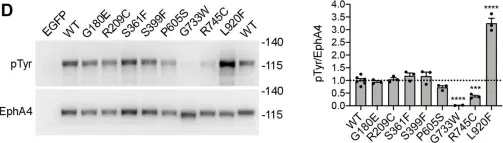 Fig.1.D showing Western Blotting in a Homo sapiens (Human) sample from the publication: A cancer mutation promotes EphA4 oligomerization and signaling by altering the conformation of the SAM domain.