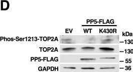 Fig.5.D showing Western Blotting in a Homo sapiens (Human) sample from the publication: SUMOylation of protein phosphatase 5 regulates phosphatase activity and substrate release.