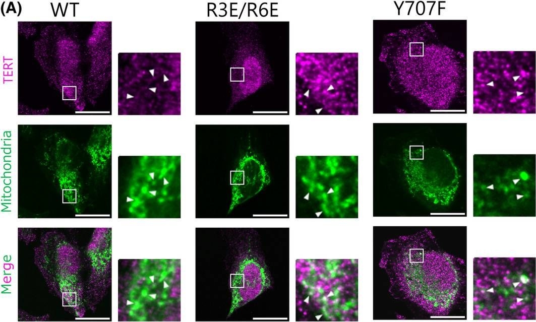 Fig.1.A showing Immunocytochemistry-immunofluorescence in a Homo sapiens (Human) sample from the publication: Accumulation of TERT in mitochondria exerts two opposing effects on apoptosis.
