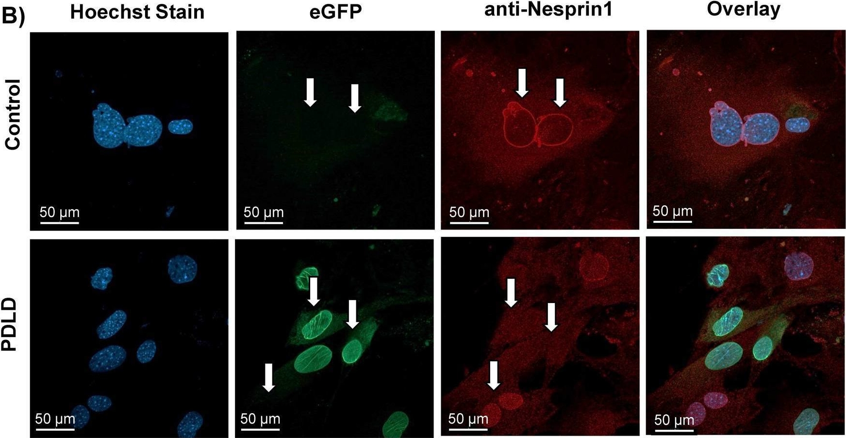 Fig.2.B showing Immunocytochemistry-immunofluorescence in a Mus musculus (House mouse) sample from the publication: Prrx1-driven LINC complex disruption in vivo reduces osteoid deposition but not bone quality after voluntary wheel running.