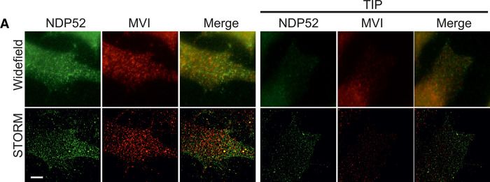 Fig.6.A showing Immunocytochemistry-immunofluorescence in a Homo sapiens (Human) sample from the publication: Binding partners regulate unfolding of myosin VI to activate the molecular motor.