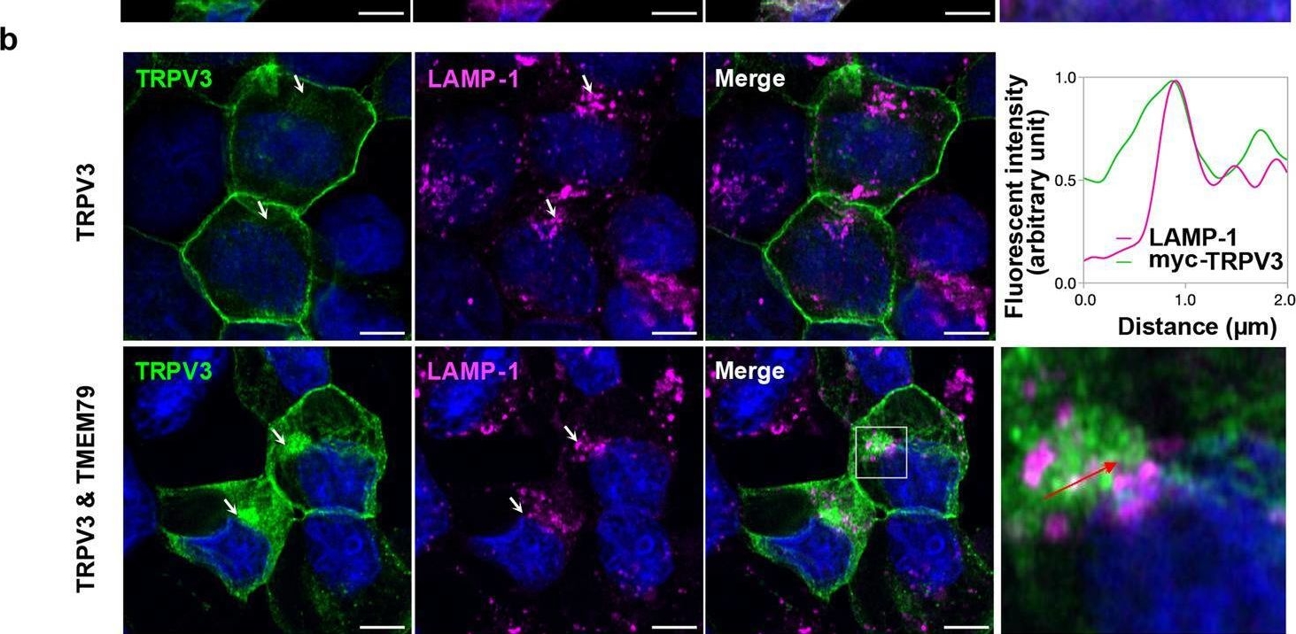 Fig.3.B showing Immunocytochemistry-immunofluorescence in a Homo sapiens (Human) sample from the publication: Involvement of skin TRPV3 in temperature detection regulated by TMEM79 in mice.