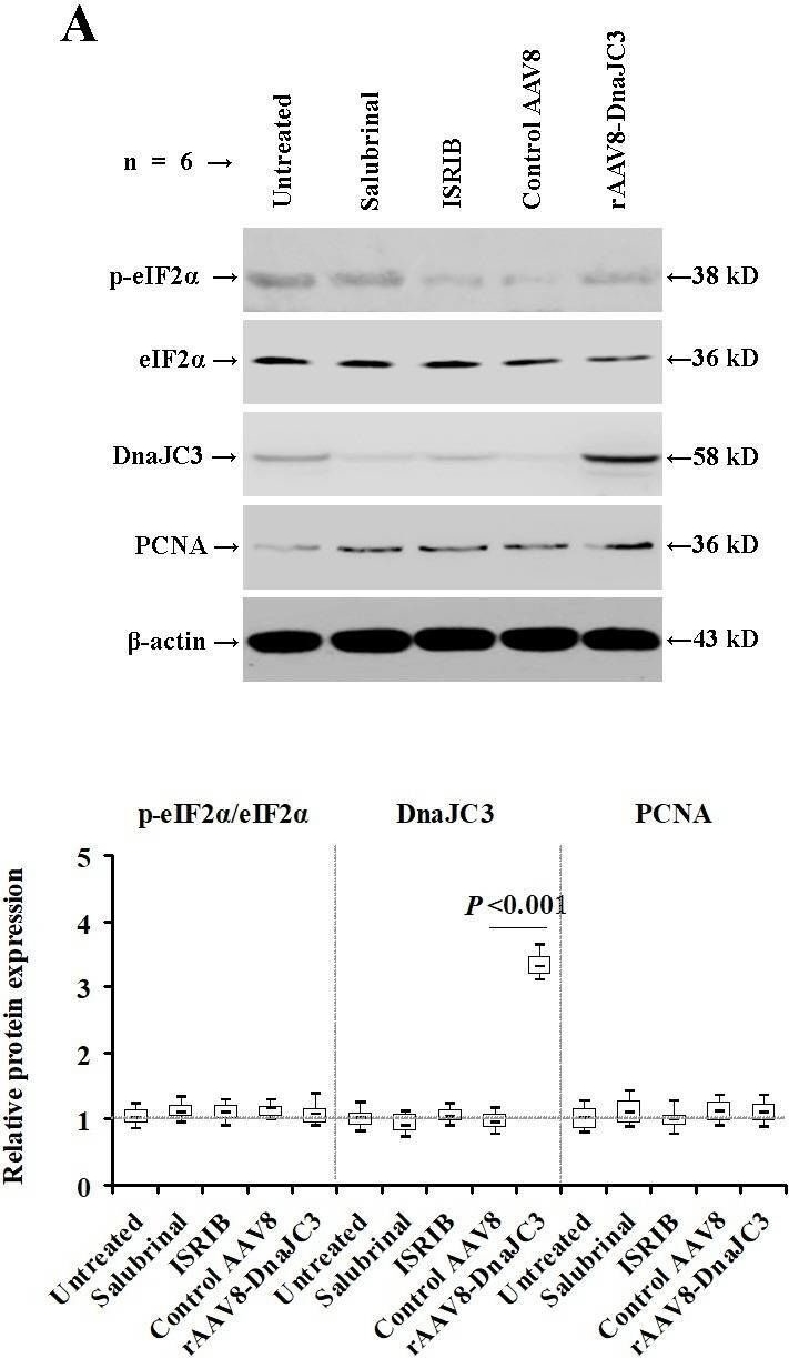 Fig.3.A showing Western Blotting in a Mus musculus (House mouse) sample from the publication: Inhibiting alpha subunit of eukaryotic initiation factor 2 dephosphorylation protects injured hepatocytes and reduces hepatocyte proliferation in acute liver injury.