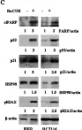 Fig.3.C showing Western Blotting from the publication: A ruthenium(II)-curcumin compound modulates NRF2 expression balancing the cancer cell death/survival outcome according to p53 status.