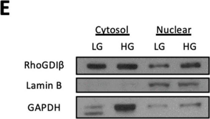 Fig.6.E showing Western Blotting in a Rattus norvegicus (Rat) sample from the publication: Hyperglycemic Stress Induces Expression, Degradation, and Nuclear Association of Rho GDP Dissociation Inhibitor 2 (RhoGDIβ) in Pancreatic β-Cells.