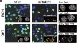 Fig.3.A showing Immunocytochemistry-immunofluorescence from the publication: The cohesin complex prevents Myc-induced replication stress.
