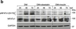 Fig.5.B showing Western Blotting in a Homo sapiens (Human) sample from the publication: Obestatin treatment links mitochondrial homeostasis and skeletal muscle repair in Duchenne muscle dystrophy.