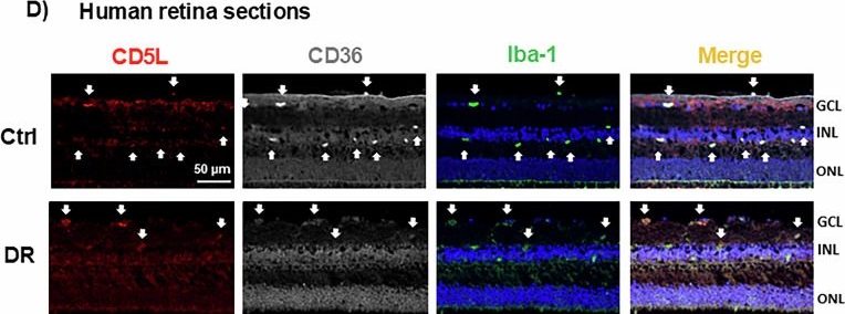 Fig.2.D showing Immunohistochemistry-immunofluorescence in a Mus musculus (House mouse) sample from the publication: CD5L promotes efferocytosis and resolution of retinal ischemic injury.