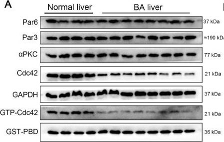 Fig.2.A showing Western Blotting from the publication: Congenital biliary atresia is correlated with disrupted cell junctions and polarity caused by Cdc42 insufficiency in the liver.