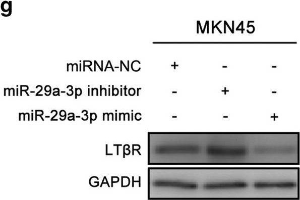 Fig.5.G showing Western Blotting in a Homo sapiens (Human) sample from the publication: LncRNA HOXA-AS3 promotes gastric cancer progression by regulating miR-29a-3p/LTβR and activating NF-κB signaling.
