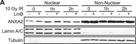 Fig.5.A showing Western Blotting in a Homo sapiens (Human) sample from the publication: Genotoxic agents promote the nuclear accumulation of annexin A2: role of annexin A2 in mitigating DNA damage.