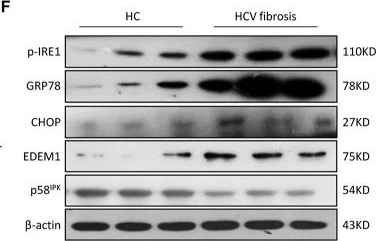 Fig.2.F showing Western Blotting in a Homo sapiens (Human) sample from the publication: Glutamate-Cysteine Ligase Catalytic Subunit Attenuated Hepatitis C Virus-Related Liver Fibrosis and Suppressed Endoplasmic Reticulum Stress.