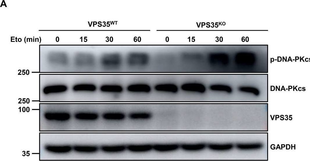 Fig.5.A showing Western Blotting in a Homo sapiens (Human) sample from the publication: Nuclear VPS35 attenuates NHEJ repair by sequestering Ku protein.