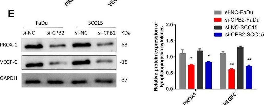 Fig.8.E showing Western Blotting in a Homo sapiens (Human) sample from the publication: Regulatory Effects of SLC7A2-CPB2 on Lymphangiogenesis: A New Approach to Suppress Lymphatic Metastasis in HNSCC.