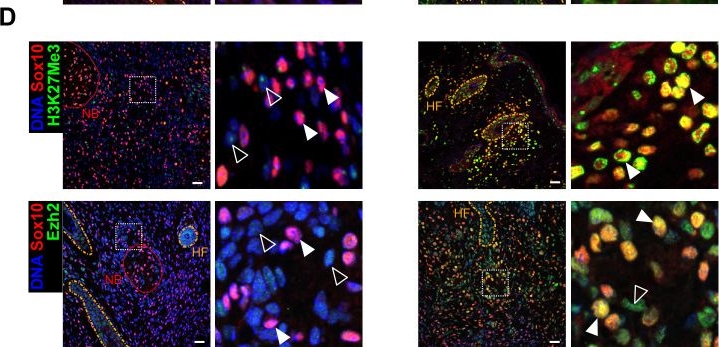Fig.2.D showing Immunohistochemistry-immunofluorescence in a Mus musculus (House mouse) sample from the publication: A novel murine model for sporadic, malignant peripheral nerve sheath tumors, driven by BrafV600E and Pten loss.