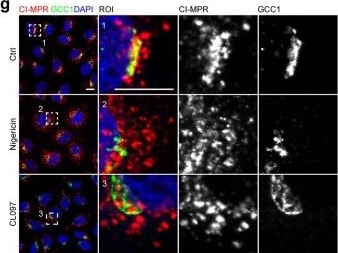 Fig.9.G showing Immunocytochemistry-immunofluorescence in a Homo sapiens (Human) sample from the publication: Distinct changes in endosomal composition promote NLRP3 inflammasome activation.