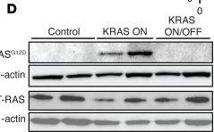 Fig.1.D showing Western Blotting from the publication: KRASG12D drives immunosuppression in lung adenocarcinoma through paracrine signaling.