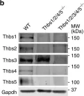 Fig.5.B showing Western Blotting in a Mus musculus (House mouse) sample from the publication: Thrombospondin-3 augments injury-induced cardiomyopathy by intracellular integrin inhibition and sarcolemmal instability.