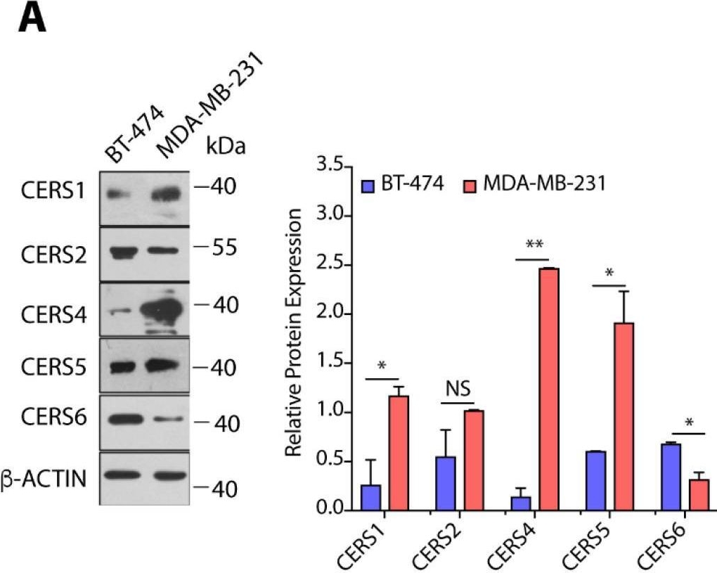 Fig.4.A showing Western Blotting in a Homo sapiens (Human) sample from the publication: Ceramide Kinase (CERK) Emerges as a Common Therapeutic Target for Triple Positive and Triple Negative Breast Cancer Cells.