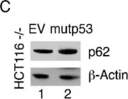 Fig.5.C showing Western Blotting from the publication: p53-R273H Sustains ROS, Pro-Inflammatory Cytokine Release and mTOR Activation While Reducing Autophagy, Mitophagy and UCP2 Expression, Effects Prevented by wtp53.