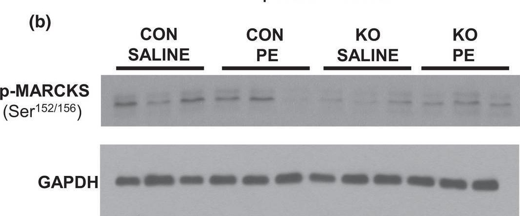 Fig.3.B showing Western Blotting from the publication: Cardiomyocyte stromal interaction molecule 1 is a key regulator of Ca2+ -dependent kinase and phosphatase activity in the mouse heart.