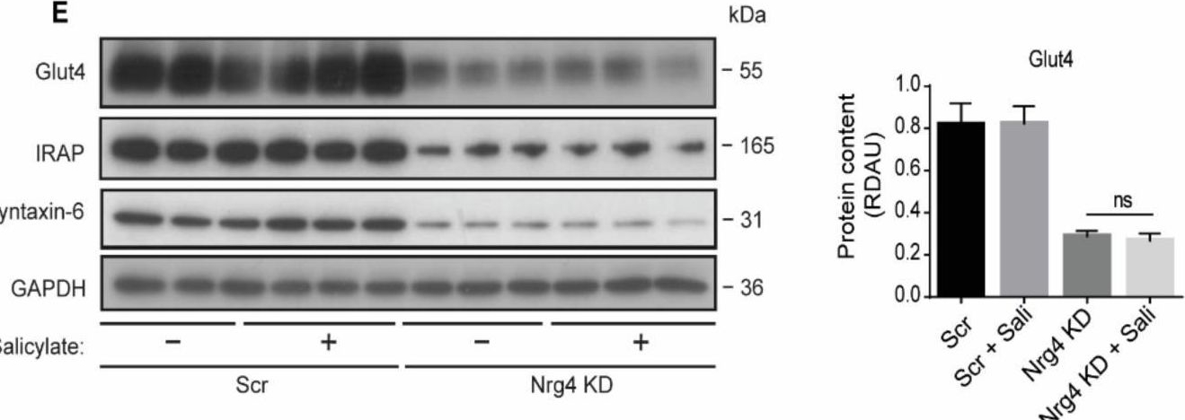 Fig.5.E showing Western Blotting from the publication: Neuregulin 4 Downregulation Induces Insulin Resistance in 3T3-L1 Adipocytes through Inflammation and Autophagic Degradation of GLUT4 Vesicles.