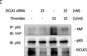 Fig.8.C showing Western Blotting in a Homo sapiens (Human) sample from the publication: Thrombin induces IL-8/CXCL8 expression by DCLK1-dependent RhoA and YAP activation in human lung epithelial cells.