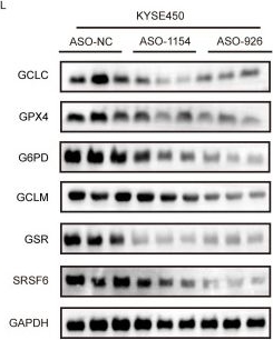 Fig.7.L showing Western Blotting from the publication: Targeting SRSF6 to Enhance Cisplatin Sensitivity by Modulating Redox Balance via NFE2L1 exon 4 Splicing in ESCC.
