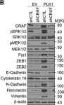 Fig.7.B showing Western Blotting in a Homo sapiens (Human) sample from the publication: Polo-like kinase 1 induces epithelial-to-mesenchymal transition and promotes epithelial cell motility by activating CRAF/ERK signaling.