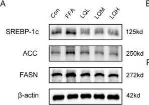 Fig.9.A showing Western Blotting in a Homo sapiens (Human) sample from the publication: Liquiritin restores metabolic homeostasis in NAFLD by modulating AKT1/FOXO1 signaling.