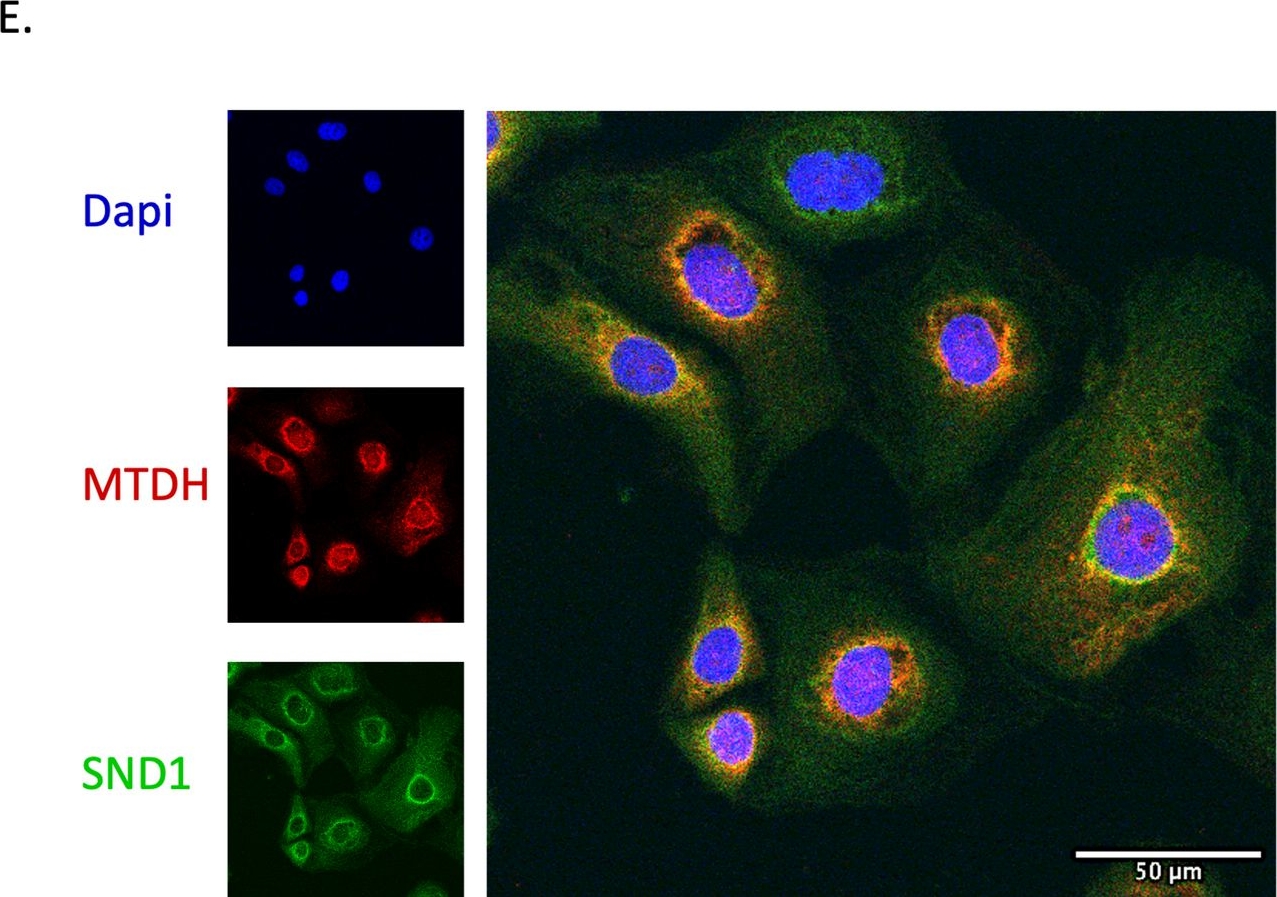 Fig.3.E showing Immunocytochemistry-immunofluorescence from the publication: Proteomics discovery of MTDH and SND1 interaction vulnerabilities in ovarian cancer.