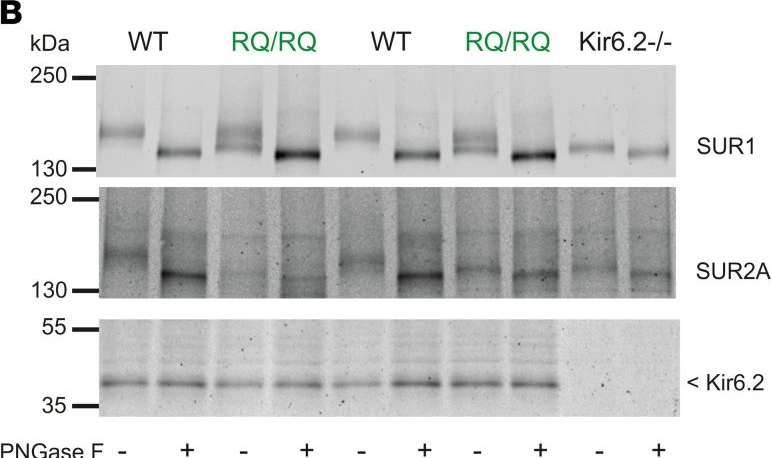 Fig.4.B showing Western Blotting from the publication: Complex consequences of Cantu syndrome SUR2 variant R1154Q in genetically modified mice.