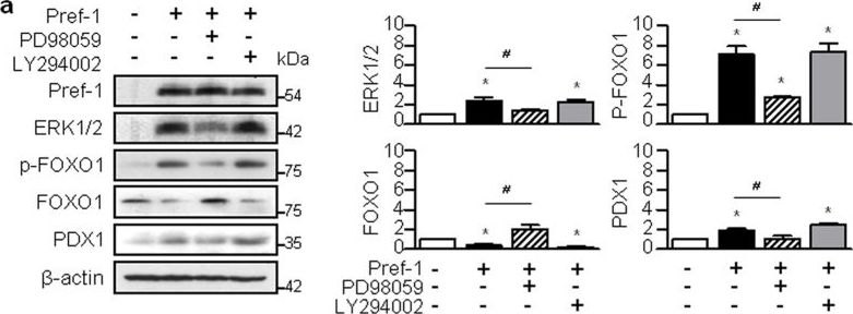 Fig.2.A showing Western Blotting in a Homo sapiens (Human) sample from the publication: Preadipocyte factor 1 induces pancreatic ductal cell differentiation into insulin-producing cells.