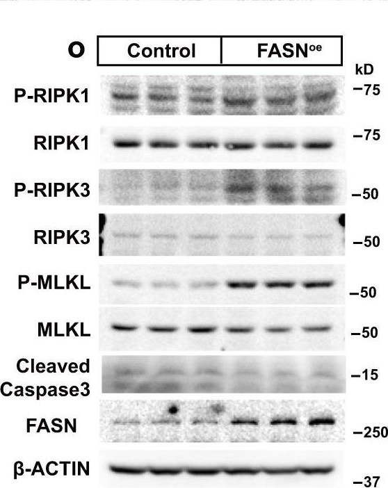 Fig.1.O showing Western Blotting from the publication: Surplus fatty acid synthesis increases oxidative stress in adipocytes and lnduces lipodystrophy.