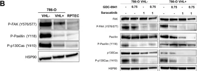 Fig.2.B showing Western Blotting from the publication: Combined inhibition of PI3K and Src kinases demonstrates synergistic therapeutic efficacy in clear-cell renal carcinoma.