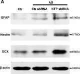 Fig.4.A showing Western Blotting in a Rattus norvegicus (Rat) sample from the publication: AD7c-NTP Impairs Adult Striatal Neurogenesis by Affecting the Biological Function of MeCP2 in APP/PSl Transgenic Mouse Model of Alzheimer's Disease.